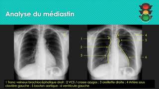 M1 Analyse de la radiographie thoracique médiastin [upl. by Dimond]