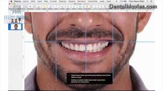 DSD  Digital Smile Design by Felipe Miguel [upl. by Nil426]