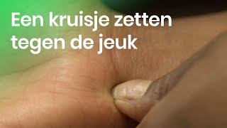 Helpt een kruisje zetten in een muggenbult tegen de jeuk  NOJ  Het Klokhuis [upl. by Namzaj]