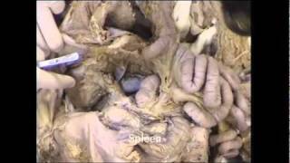 Kidney and posterior abdominal wall  dissection [upl. by Ennairda144]