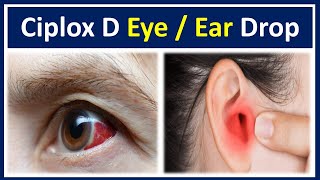 Ciplox d eye ear drops  Ciprofloxacin dexamethasone eye ear drops ciplox d  Ciplox d eye drops [upl. by Ellebana]