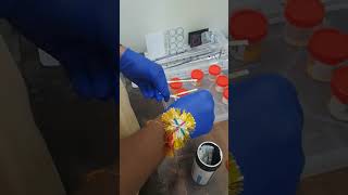 urinetest strip shorts lab video creator shortfeed viral medicalstudent labtechnicians [upl. by Ahser349]