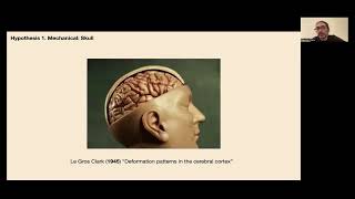 OHBM 2024  Educational Course  Precision surface imaging of the cerebral cortex  Part 7 [upl. by Etnaud814]