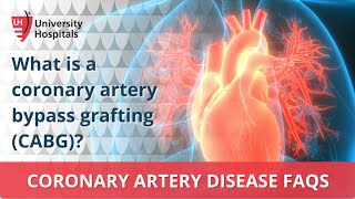 What is a coronary artery bypass grafting CABG [upl. by Anaoy175]