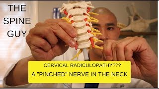 CERVICAL STENOSIS RADICULOPATHY PART 1  SYMPTOMS IMAGING AND PATIENT EXAM [upl. by Jill]