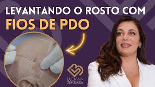 Veja a Colocação de FIOS DE SUSTENTAÇÃO PDO Harmonização Facial  Dra Luciana Villas Bôas [upl. by Ardien]