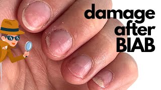 How to correct damage after BIAB Builder in a bottle Annas Nail Advice [upl. by Collayer]