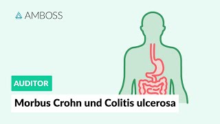 Morbus Crohn und Colitis ulcerosa  Worin unterscheiden sie sich  AMBOSS Auditor [upl. by Pooi]