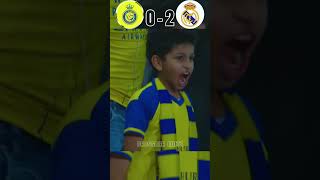 Ronaldo Injured And Mbappe Cry  Al Nassr VS Real Madrid Imaginary Final  ronaldo vs mbappe [upl. by Nhepets]