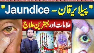 Jaundice Symptoms and Treatment  Jaundice Foods To Eat and Avoid  Pela Yarkan Ka ilaj [upl. by Eiramasil]