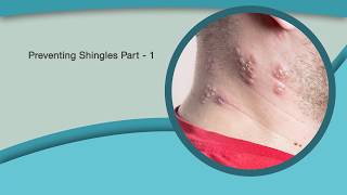 Preventing Shingles Part 1 [upl. by Raynard]