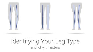 iWALK30 amp 20 Support  Identify Your Leg Type [upl. by Yelyah39]