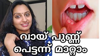 മുഖം വെട്ടിത്തിളങ്ങാൻ  home remedy for skin whitening  latest malayalam health tips [upl. by Jelks470]