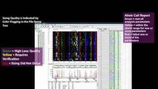 AneuploidyTrisomy Analysis with GeneMarker® Software [upl. by Kylynn]