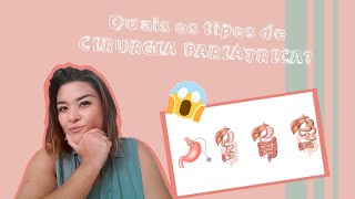 Quais são os tipos de cirurgia bariatrica [upl. by Rosabel]