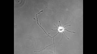 Differentiation of hippocampal neuron in cuture [upl. by Verdi]