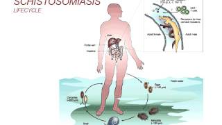 Webinar Schistosomiasis  Diagnosis and Treatment 2014 [upl. by Sherrill]