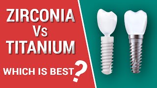 Zirconia Vs Titanium Dental Implants [upl. by Ennaeirrac969]