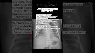 Respiratory conditions in newborns [upl. by Flyn]