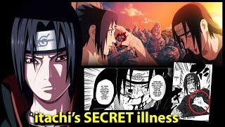 the REAL reason Itachi Uchiha Died  Itachis Secret illness Explained  Naruto amp Boruto Theory [upl. by Ikey]