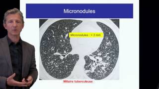 ECN PID cours 1 DFASM1 Diagnostic des PID Pr V Cottin Lyon [upl. by Aiehtela]