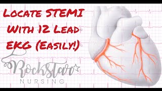 Locate and interpret STEMI based on 12 Lead EKG [upl. by Nuncia]