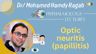 Neuro 2 Optic neuritis papillitis [upl. by Sirromal]