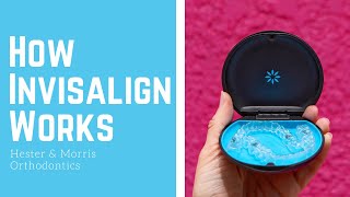 How Invisalign Works [upl. by Aissila649]