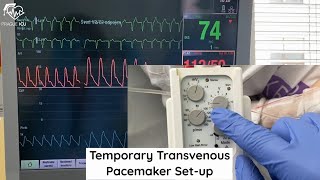 Temporary transvenous pacemeker setup [upl. by Yllaw]