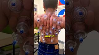 This is an extremely strange procedure 😲viral satisfying weird shorts [upl. by Ley]