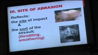 Forensic  Dr Abeer  Wounds 1  Part 1 [upl. by Entwistle]