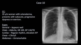 How to Interpret a Chest XRay Lesson 10  Self Assessment Part 2 [upl. by Bouley]