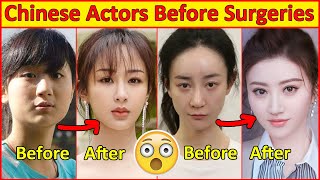 Chinese Actors Before and After Plastic Surgeries 😮  Incredible Changes Chinese Drama [upl. by Pell356]