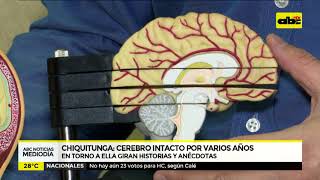 El cerebro de Chiquitunga [upl. by Drapehs]