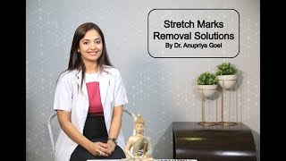 Stretch Marks Removal Solutions By Dr Anupriya Goel [upl. by Aiekahs]