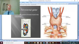 Thyroid disorders in Arabic 7  Retrosternal Goiter   by Dr Wahdan [upl. by Dyol721]