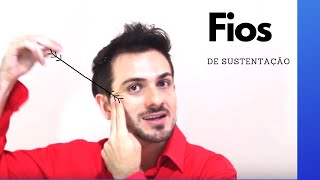 Fios de Sustentação  Harmonização Facial I Dr Diogo Branco [upl. by Wolk]