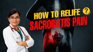 Sacroiliitis का इलाज  IPSC Hospital  Sacroiliitis health [upl. by Dudley]