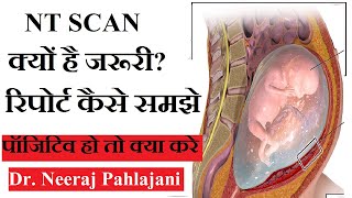 NT Scan in Hindi  प्रेगनेंसी के 13 हफ्ते का सबसे जरूरी टेस्ट NT Test [upl. by Ahsael]