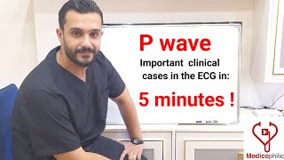 As simple as this  Mastering P wave clinical cases in the ECG in 5 minutes [upl. by Clippard]