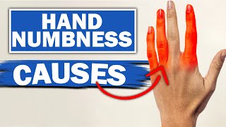 Expert Reveals MindBlowing Facts About Numbness amp Tingling In Fingers [upl. by Eimat]