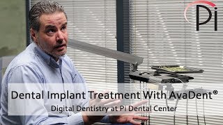 AvaDent® Digital Dental Implants and Treatment [upl. by Feldman]