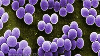 Staphylococcus aureus [upl. by Ihculo]