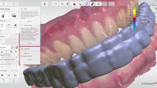 How to design and print an occlusal splint using 3Shape [upl. by Akceber]