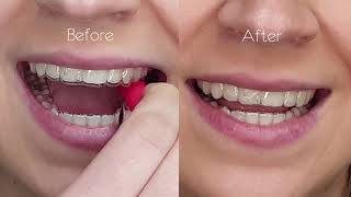 How to properly use your chewies  Gentle Dental Care Group [upl. by Sheaff]