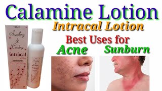 Calamine lotion  itching amp acne  Intracal lotion uses side effects in hindi  by dawa jankari [upl. by Aibun]