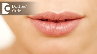 What causes dark spots around lips  Dr Rajdeep Mysore [upl. by Nayllij]