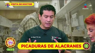 Picadura de alacrán síntomas riesgos y tratamiento  Sale el Sol [upl. by Nollid356]