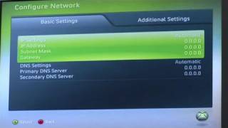 How To Connect Your Xbox 360 Live [upl. by Tamqrah309]