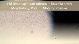 Motility of Bacteria [upl. by Enamrahs]